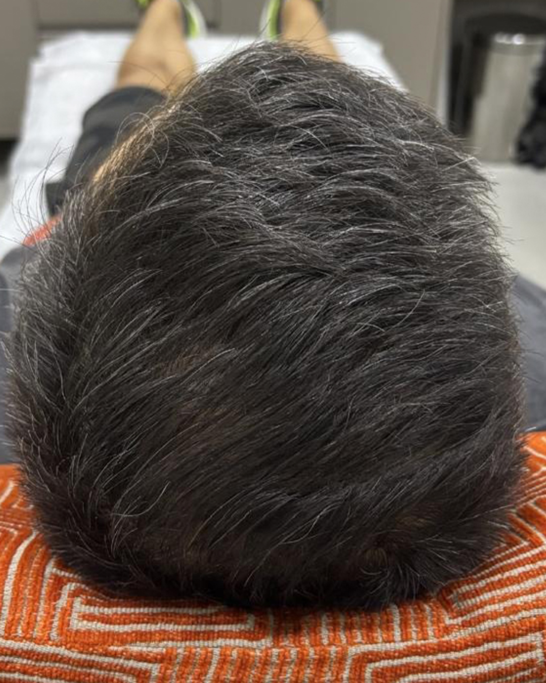 Depois do tratamento